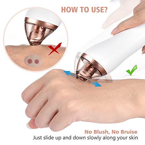 4 in 1 Deep Pore and Blackhead Cleaner